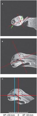 The Mysterious Island: Insula and Its Dual Function in Sleep and Wakefulness